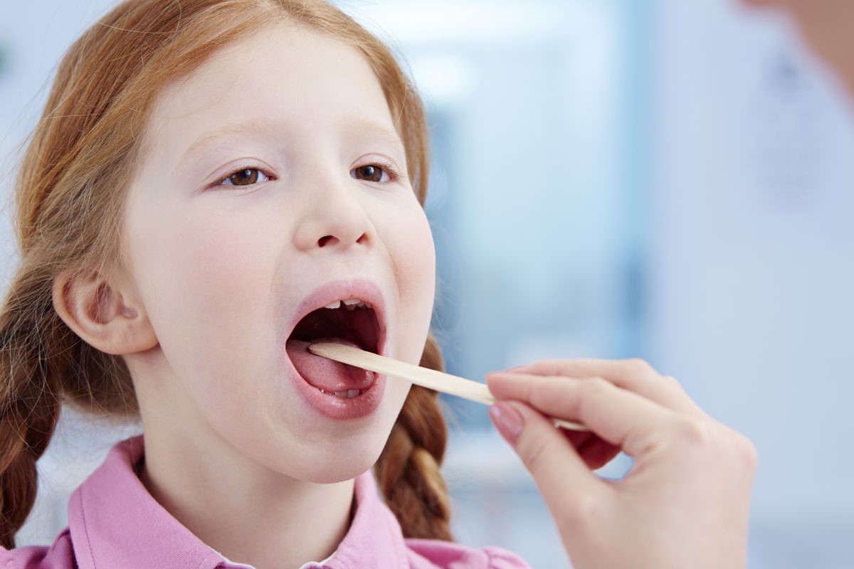  Viêm amidan hốc mủ có nên cắt không sẽ do bác sỹ chỉ định.