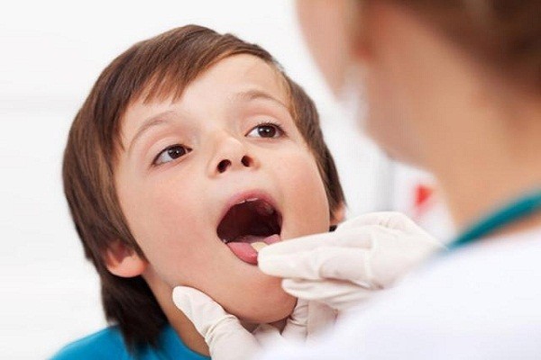  Trẻ bị viêm amidan kéo dài có thể gây áp xe, mãn tính.