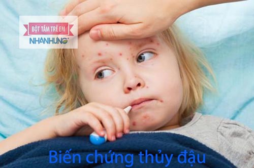Biến chứng viêm não vô cùng nguy hiểm
