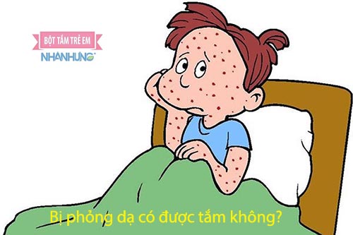 Bị phỏng dạ không cần kiêng nước