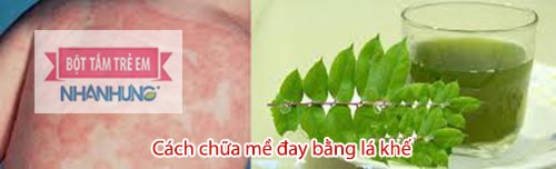 Uống nước lá khế giúp loại bỏ mề đay