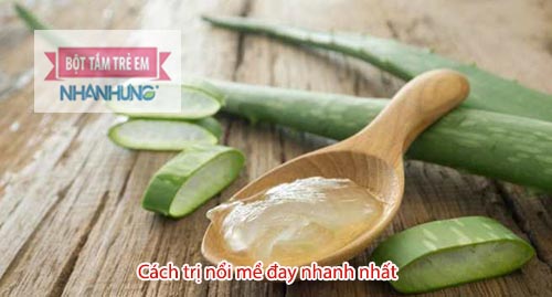 Đắp gel lô hội giúp da trẻ dễ chịu hơn