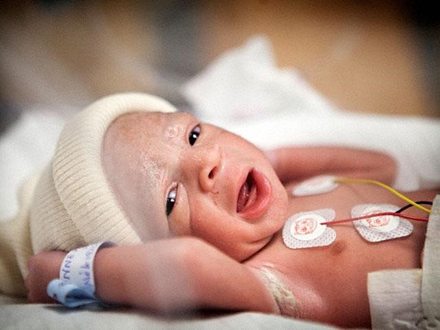 Bé bị suy dinh dưỡng sẽ rất nguy hiểm