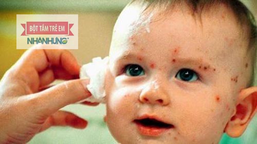 Khi phát bệnh người bệnh cần được chăm sóc đặc biệt