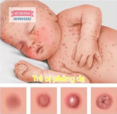 Trên da trẻ nổi các nốt phỏng nhỏ có màu hồng, nổi gồ lên trên da
