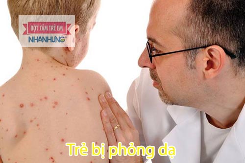 Khi trẻ có dấu hiệu bội nhiễm cần đưa tới cơ sở y tế ngay lập tức