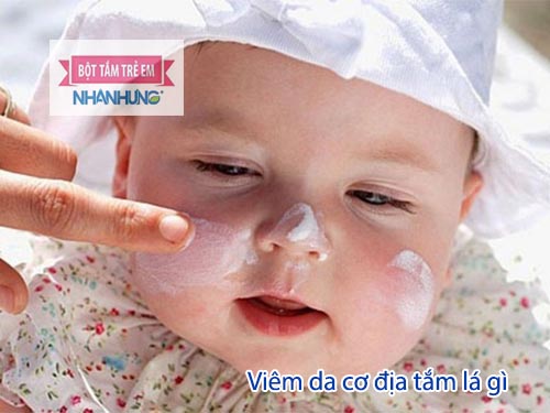 Điều trị viêm da cơ địa của trẻ cần có thêm kem dưỡng ẩm