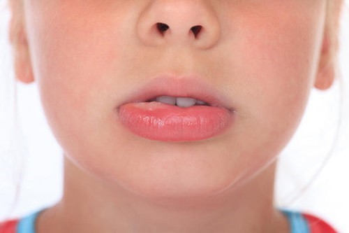 Vệ sinh răng miệng sạch sẽ cho bé với dung dịch nước muối.