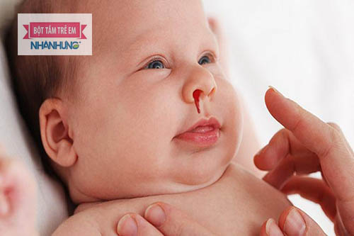 Cách chữa chảy máu cam cho trẻ - mũi bị khô thì niêm mạc mũi cũng sẽ bị nứt nẻ ra, từ đó tác động đến các mao mạch máu nhạy cảm trong khoang mũi
