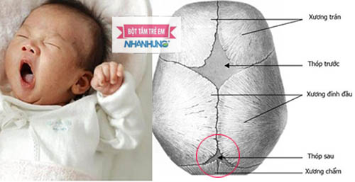 Nếu thóp sau sưa đóng hay bị lõm mẹ cần cẩn trọng với các bệnh dưới đây