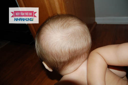 Trẻ bị lõm thóp sau do thiếu nước