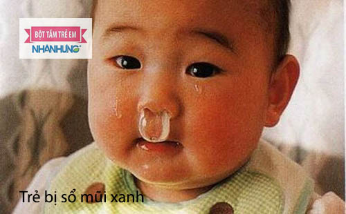 Trẻ bị thò lò nước mũi màu xanh nhạt