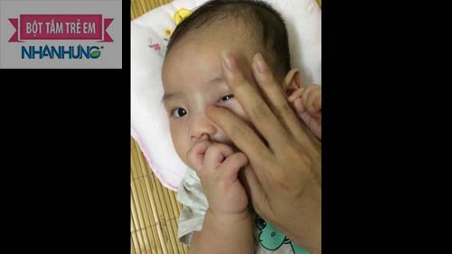 Massage nhẹ nhàng tuyến lệ cho bé