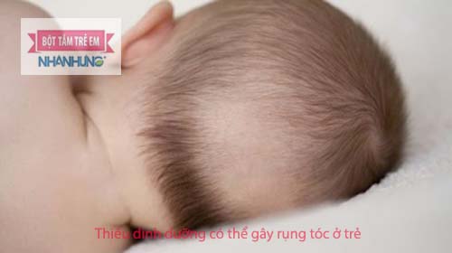 Trẻ sơ sinh bị rụng tóc ở thóp có thể do thiếu dinh dưỡng.