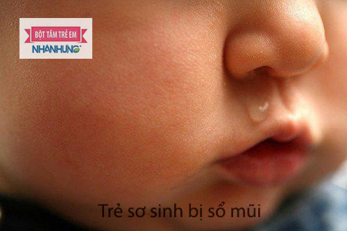 Trẻ dễ bị sổ mũi cũng là do sức đề kháng kém nên dễ bị vi khuẩn, virut tấn công