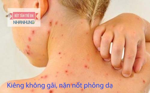 Tuyệt đối không cào, gãi, nặn các nốt phỏng dạ ở trẻ