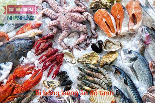 Bị bỏng kiêng hải sản