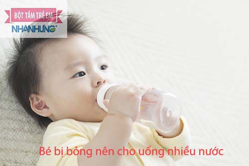 Bé bị bỏng nên cho uống nhiều nước mỗi ngày