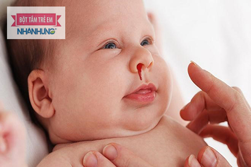 Chảy máu cam có thể chảy ra ngoài hoặc ngược vào trong họng.