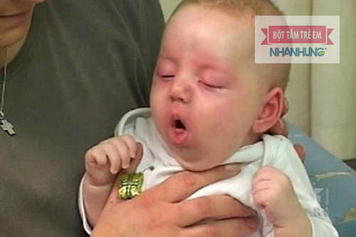 Cho bé ăn sai tư thế có thể khiến bé bị sặc và nôn trớ