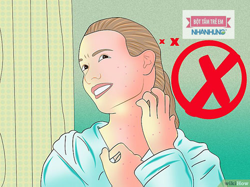 Không gãi vào vùng da bị phỏng dạ khiến mụn nước vỡ ra