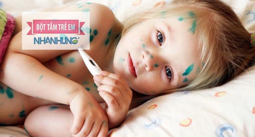 Trẻ bị thủy đậu cần được vệ sinh thân thể hàng ngày để tránh viêm nhiễm