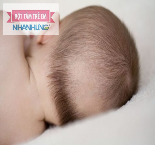 Bé bị rụng tóc từng mảng có thể do thiếu chất hoặc mắc bệnh tự miễn dịch.