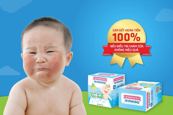 Bột tắm trẻ em Nhân Hưng cam kết trị dứt điểm bệnh chàm sữa cho trẻ sơ sinh