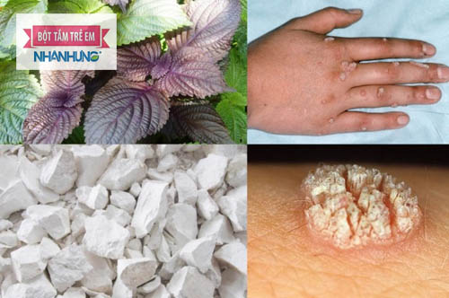 Lá tía tô có tác dụng ức chế sự phát triển của vi khuẩn, virus HPV 