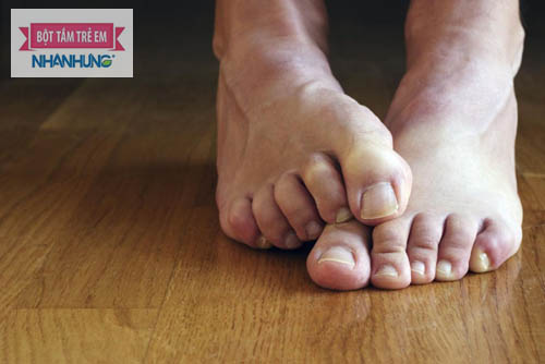 Tránh gãi khi bị nước ăn chân nhằm ngăn ngừa trầy xước, nhiễm trùng