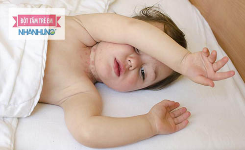 Trẻ nổi mẩn đỏ ở cổ do nhiều nguyên nhân