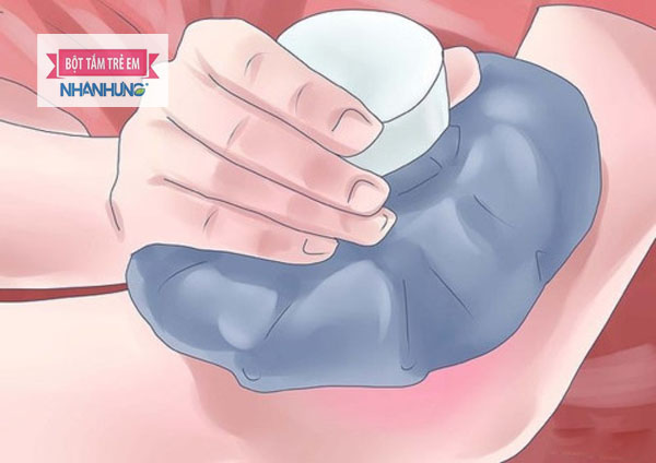 Chườm lạnh là phương pháp có thể điều trị ngay tại nhà