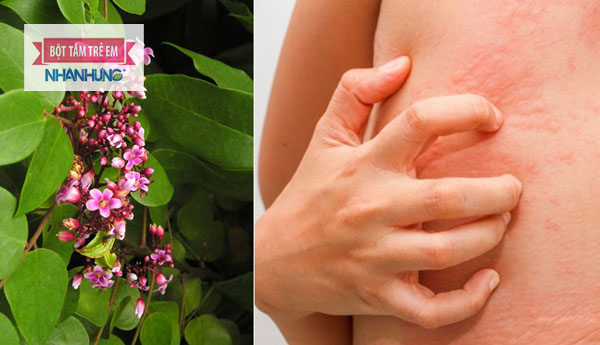 Lá khế, lá kinh giới, gừng trị mề đay mẩn ngứa rất hiệu quả