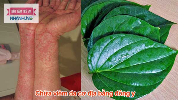 Lá trầu không có tác dụng chống viêm, kháng khuẩn và điều trị viêm da cơ địa
