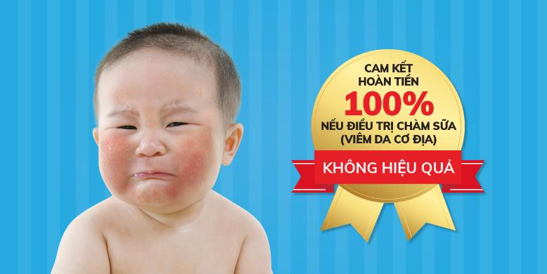 Bột tắm Nhân Hưng điều trị dứt điểm triệu chứng viêm da cơ địa (chàm sữa) ở trẻ sau 1 liệu trình