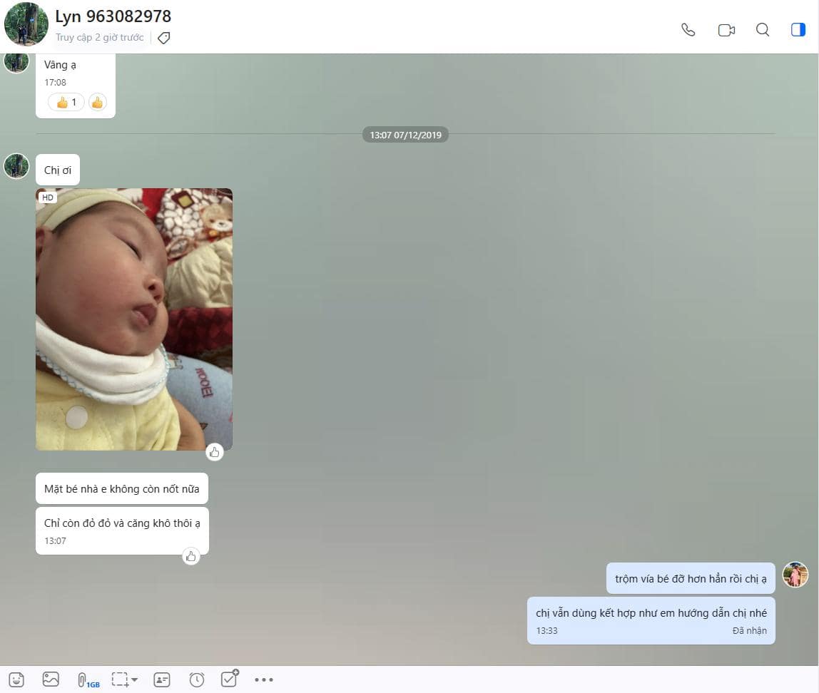 Mẹ Việt phản hồi “cực chất” về bộ đôi loại bỏ chàm sữa ở trẻ