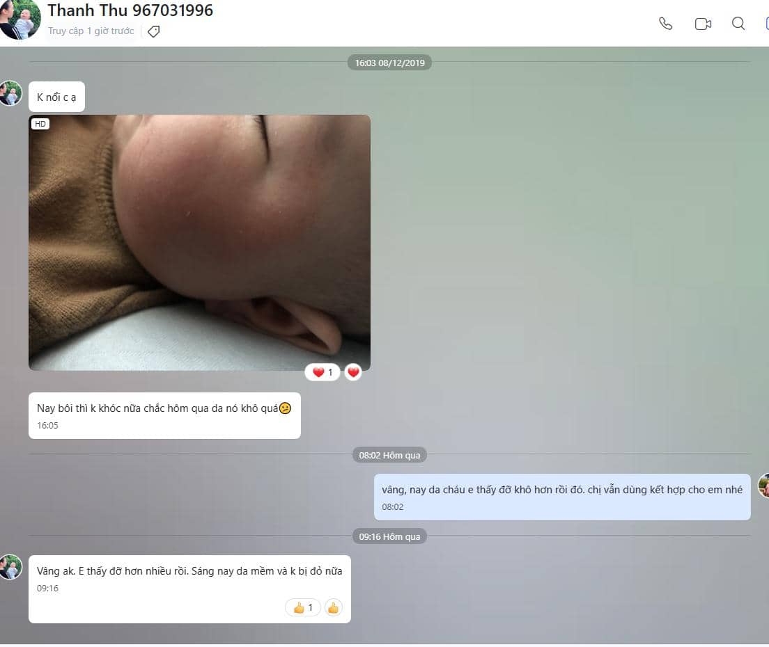 Mẹ Thanh Thu chia sẻ về bộ đôi trị chàm sữa