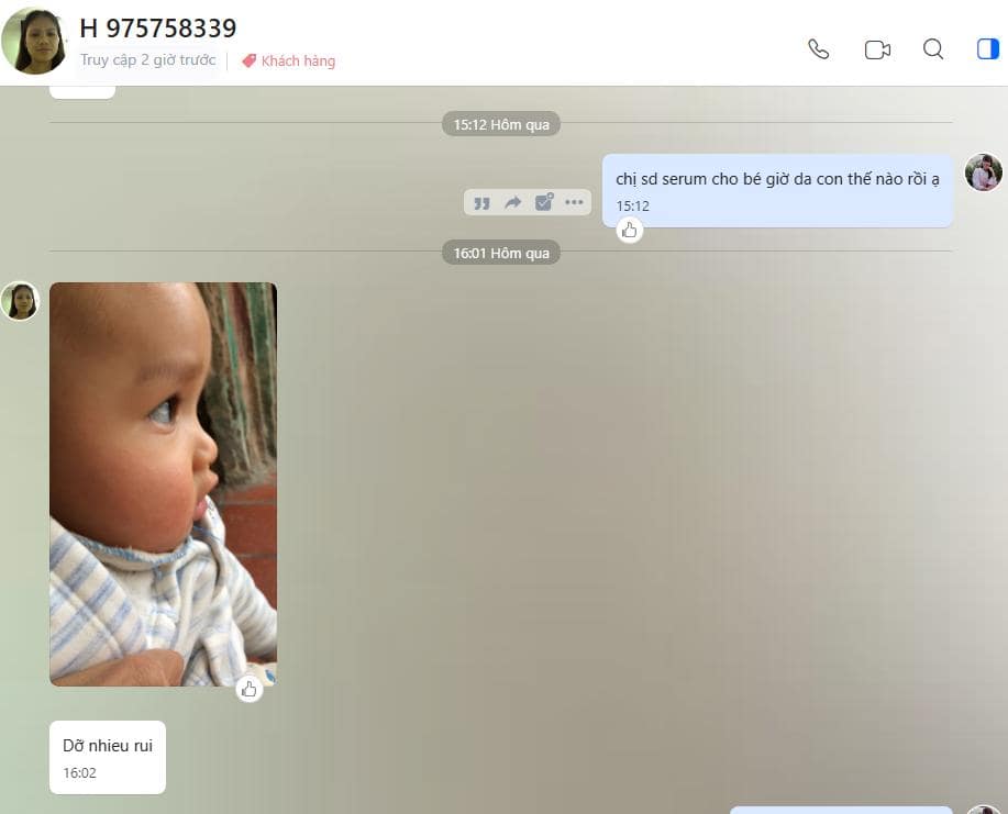 Wao, các mẹ có tưởng tượng được không, trước đó vài ngày con bị chàm sữa nặng lắm đó, vậy mà sau khi sử dụng bộ đôi loại bỏ chàm sữa, giờ da con nhẵn thín luôn.
