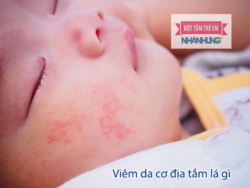 Lá tắm trị viêm da cơ địa cho trẻ em