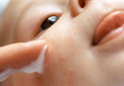 Vệ sinh đúng cách hàng ngày kê sữa ở trẻ sơ sinh sẽ tránh xa 