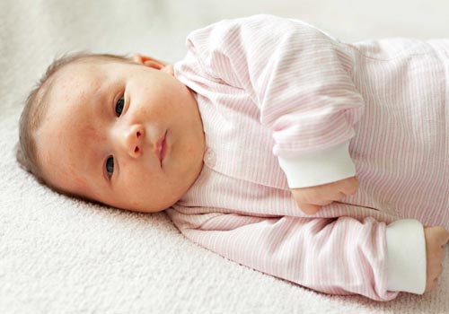 Kinh nghiệm trị mẩn ngứa dứt điểm ở trẻ sơ sinh và trẻ nhỏ