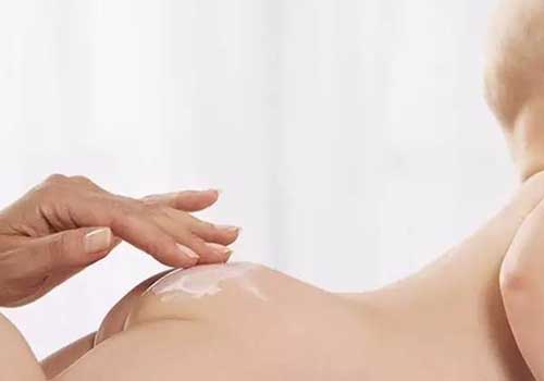 Nên thận trọng khi bôi kem trị hăm cho trẻ