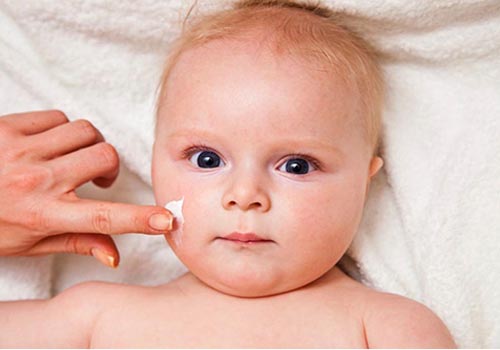 Giữ trẻ tránh xa các yếu tố gây bệnh viêm da