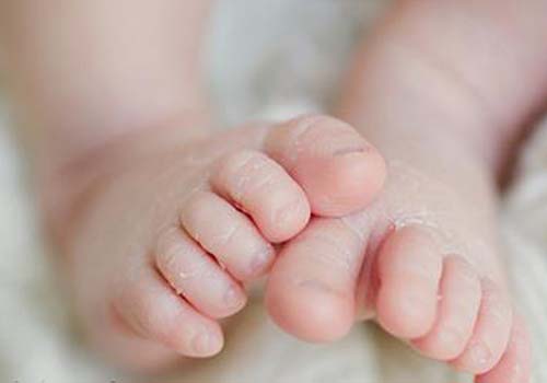 Khô da ở trẻ em là biểu hiện của làn da bị mất cân bằng ẩm