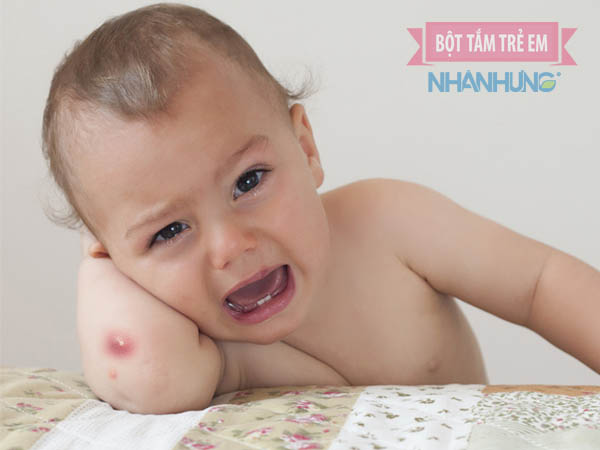 Mụn bọc gây đau đớn, khó chịu cho trẻ