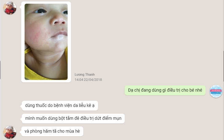 Mẹ chia sẻ về bột tắm nhân hưng trị chàm sữa