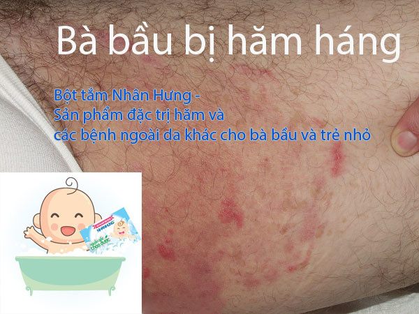 Bà bầu bị hăm háng