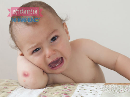 Bé bị mụn nhọt thường hay khó chịu quấy khóc