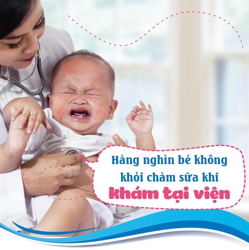 Đi bệnh viện khi bị chàm sữa có phải là lựa chọn đúng đắn của mẹ Việt?