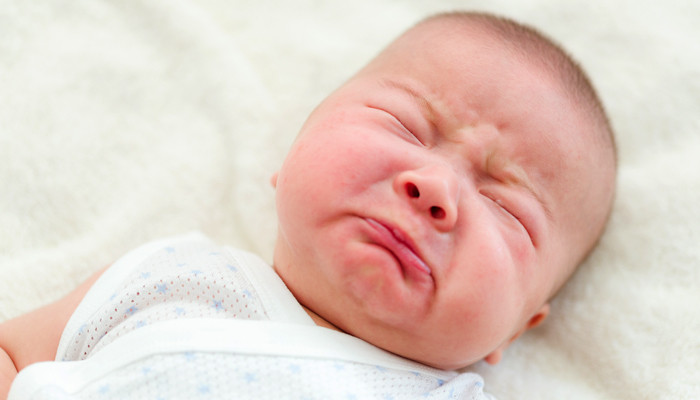 tình trạng chàm sữa trên mặt: căng da, khô da, tấy đỏ...